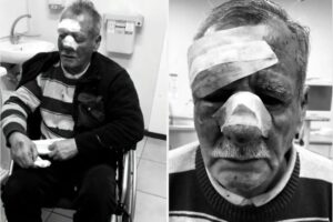 Agresión brutal a conductor de 73 años: «Estudiante quedó con arresto domiciliario tras provocarle fracturas en el rostro».